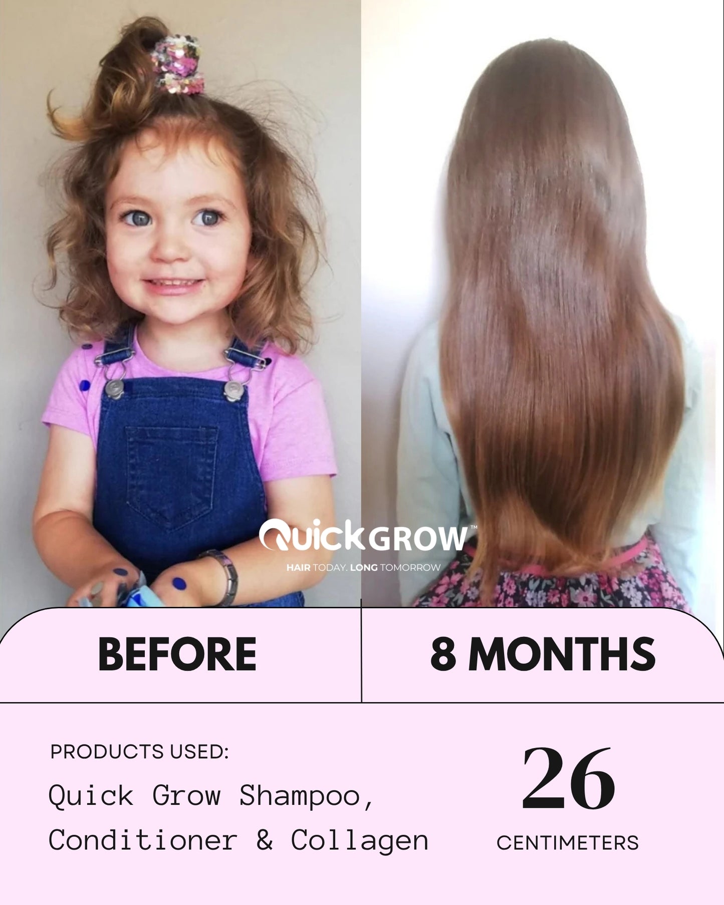 Biotin Shampoo (250ml)