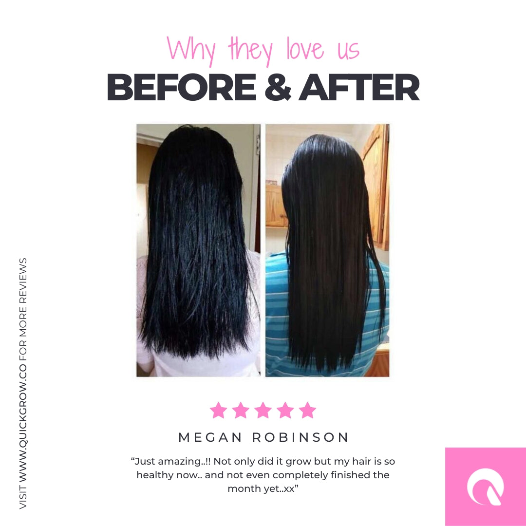 hair growth capsules