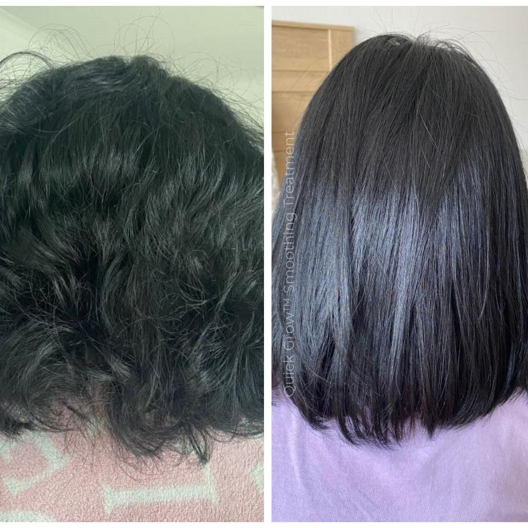 Quick Grow Smoothing Treatment Before After